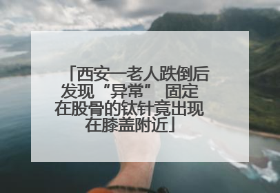 西安一老人跌倒后发现“异常” 固定在股骨的钛针竟出现在膝盖附近